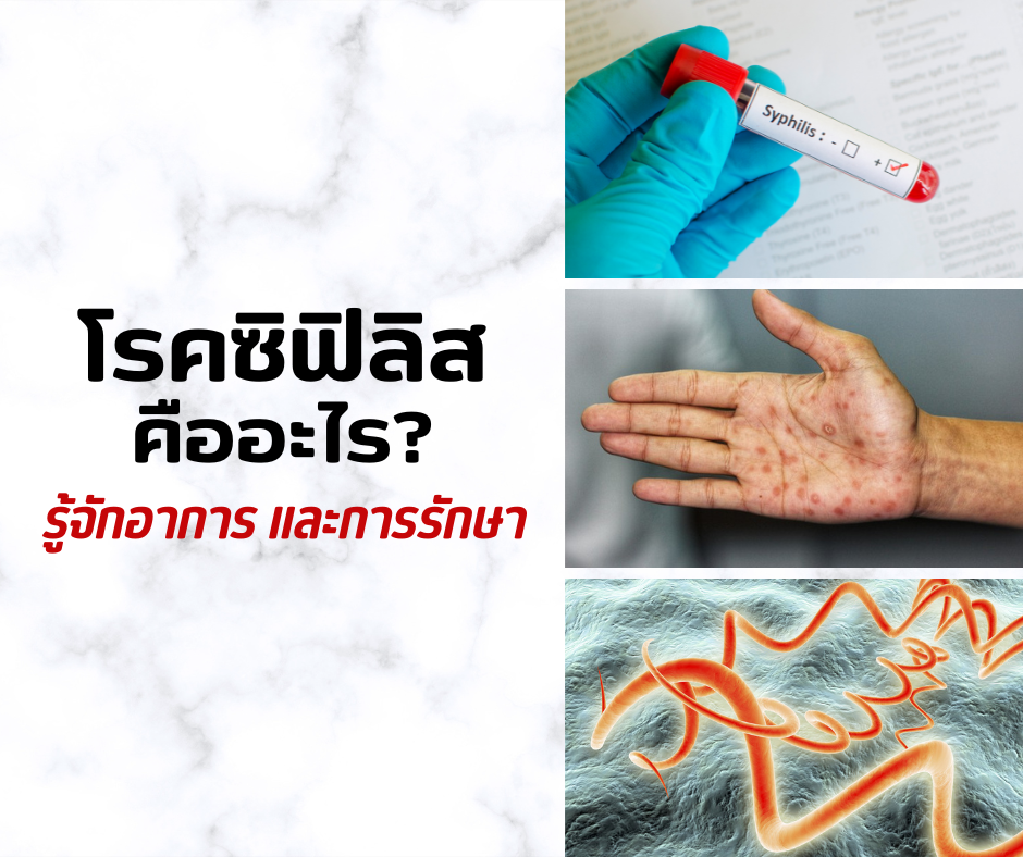 โรคซิฟิลิส คืออะไร? รู้จักอาการและการรักษา