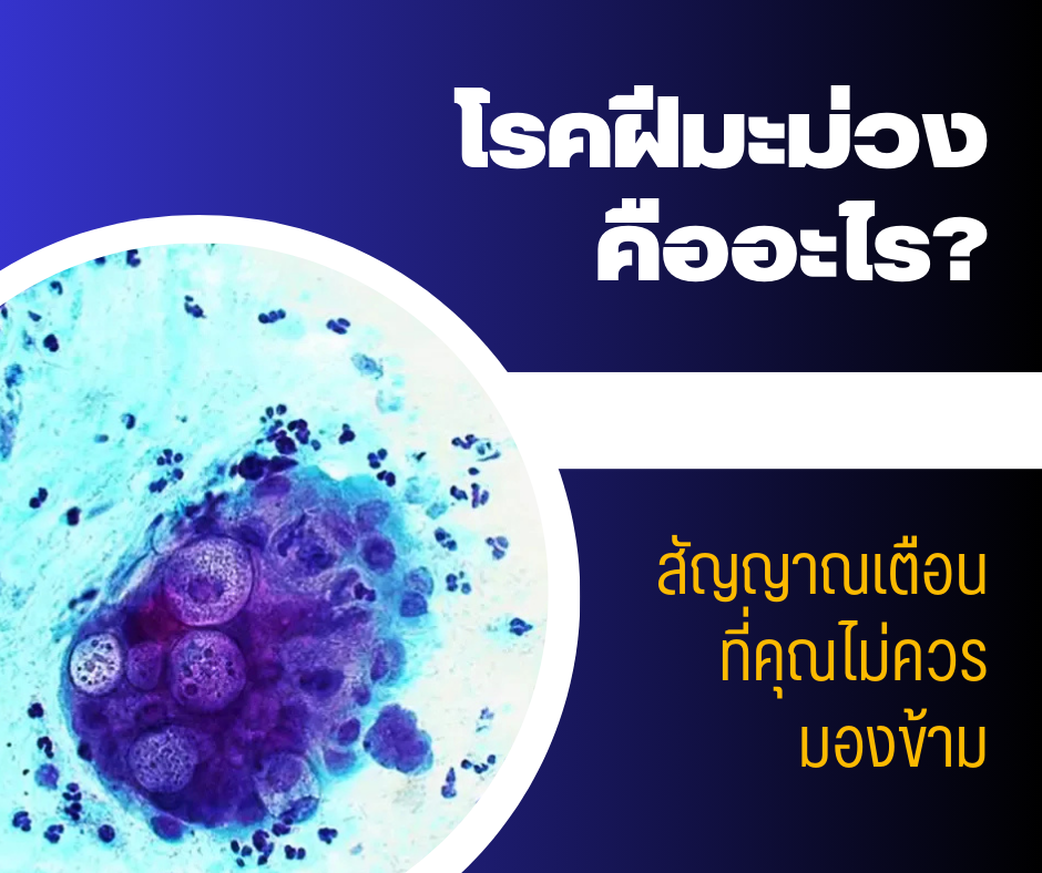 โรคฝีมะม่วง คืออะไร? สัญญาณเตือนที่คุณไม่ควรมองข้าม