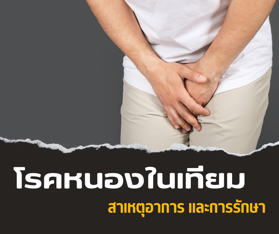 โรคหนองในเทียม สาเหตุ อาการ และการรักษา