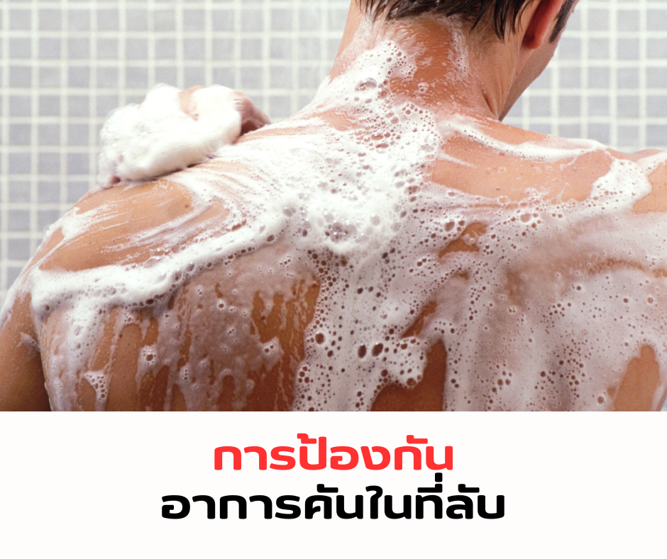 การป้องกันอาการคันในที่ลับ