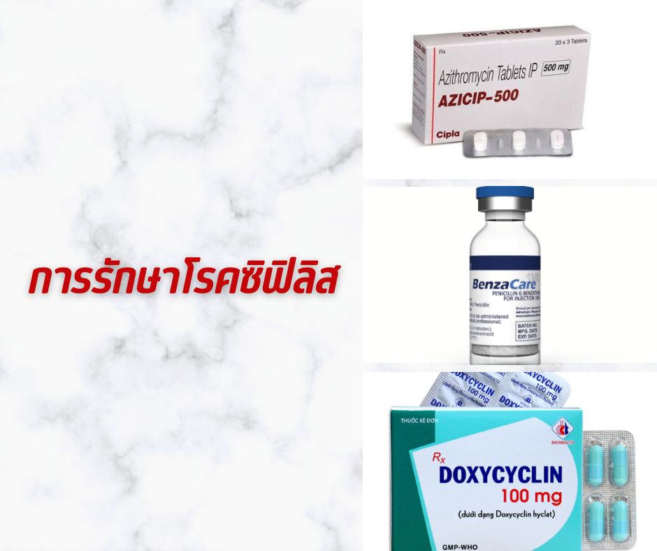 การรักษาโรคซิฟิลิส