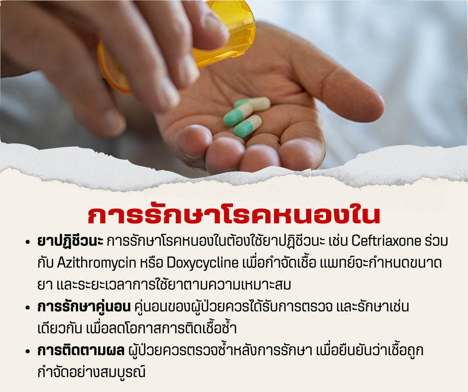 การรักษาโรคหนองใน