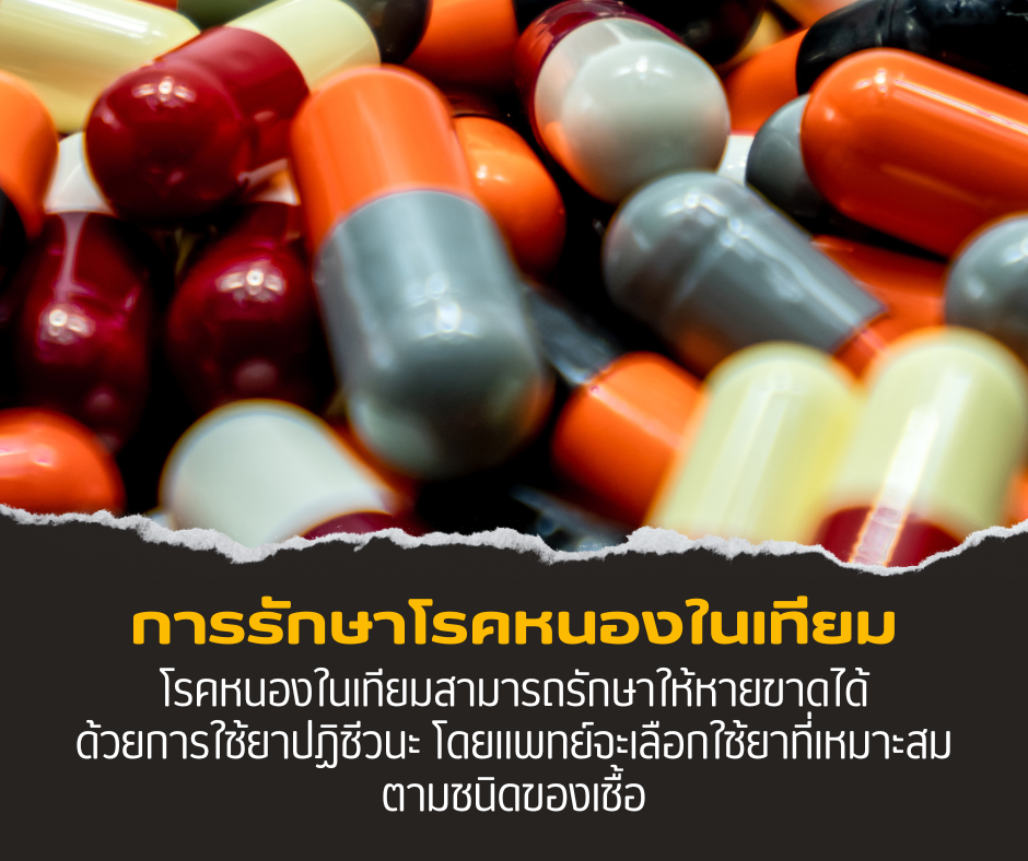 การรักษาโรคหนองในเทียม