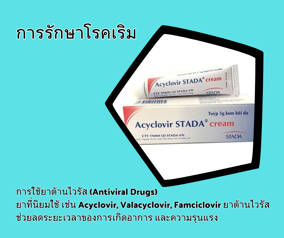 การรักษาโรคเริม