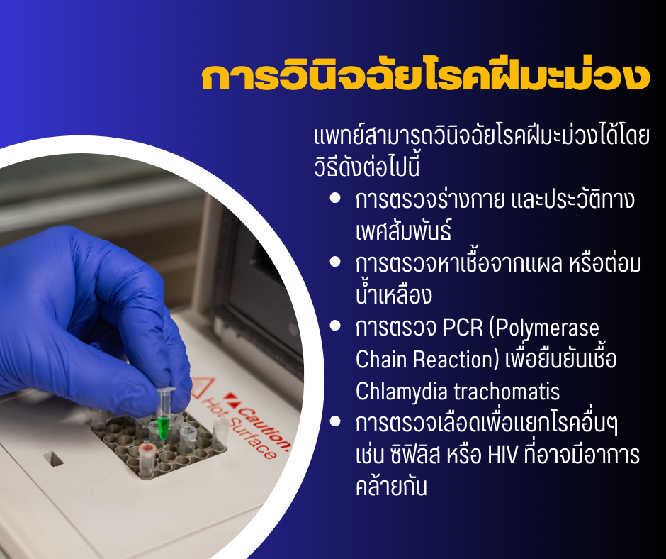 การวินิจฉัยโรคฝีมะม่วง