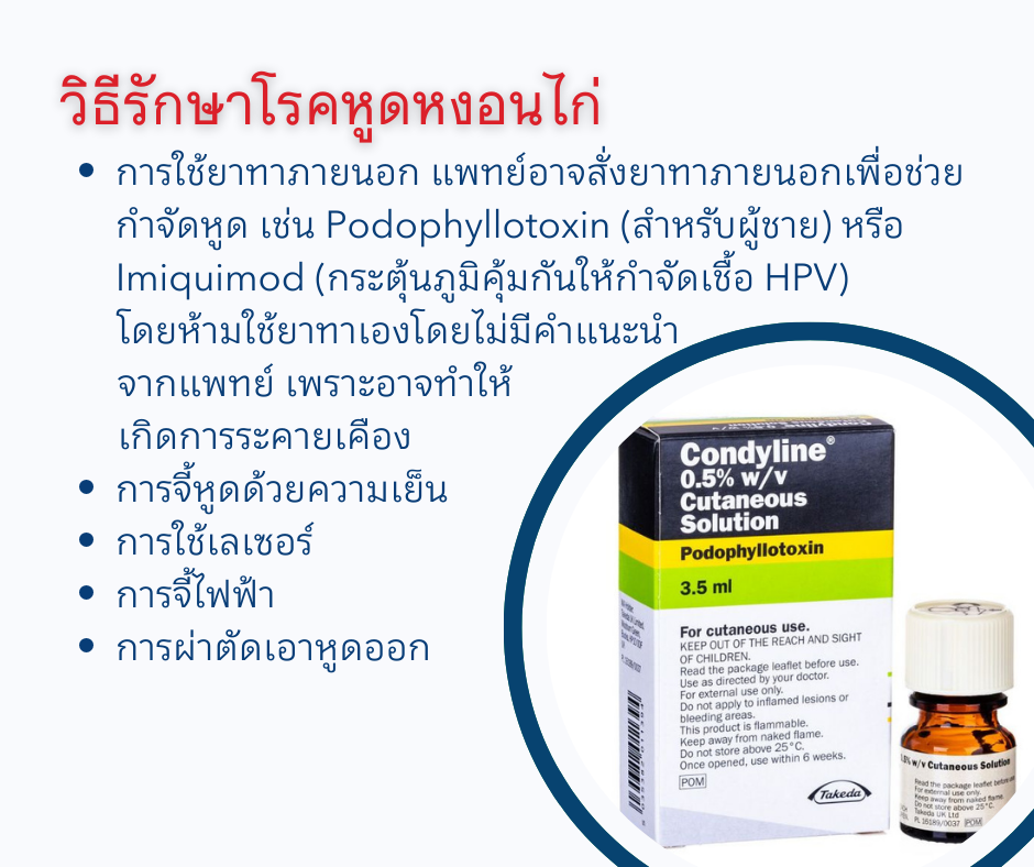 วิธีรักษาโรคหูดหงอนไก่