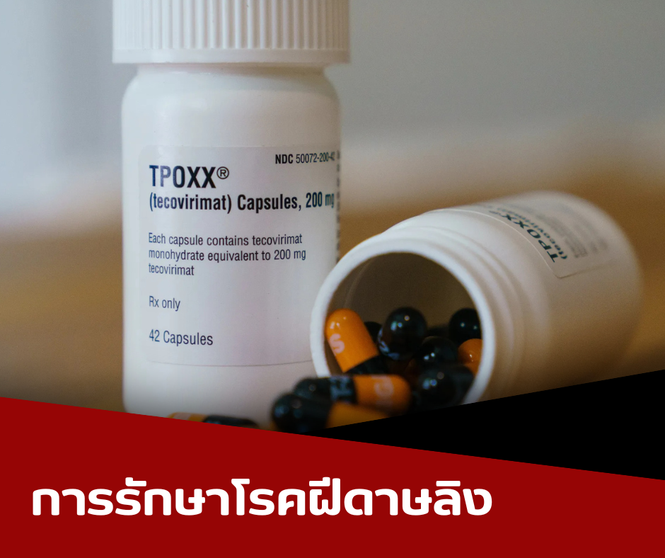 การรักษาโรคฝีดาษลิงpng