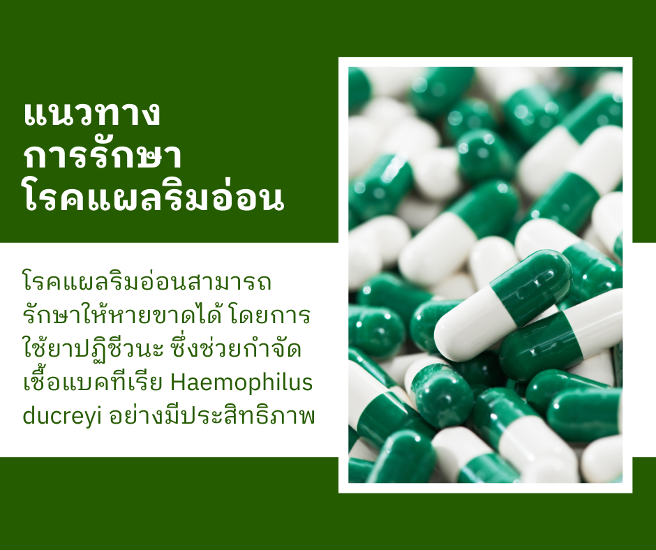 แนวทางการรักษาโรคแผลริมอ่อน