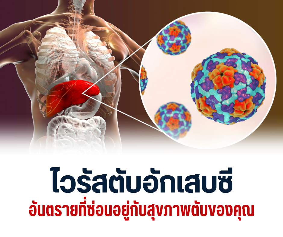 ไวรัสตับอักเสบซี อันตรายที่ซ่อนอยู่กับสุขภาพตับของคุณ