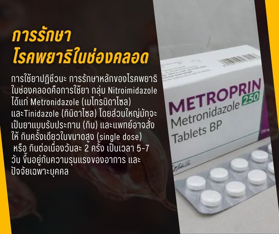 การรักษาโรคพยาธิในช่องคลอด