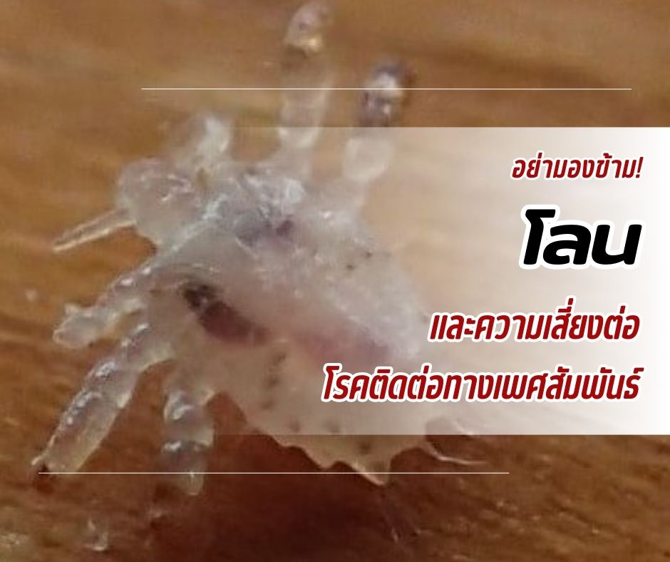 อย่ามองข้าม! โลน และความเสี่ยงต่อโรคติดต่อทางเพศสัมพันธ์