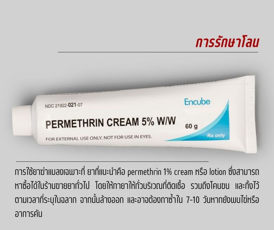 การรักษาโลน