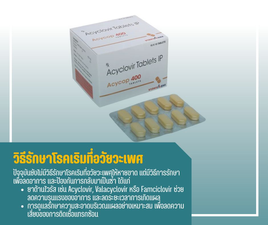 วิธีรักษาโรคเริมที่อวัยวะเพศ