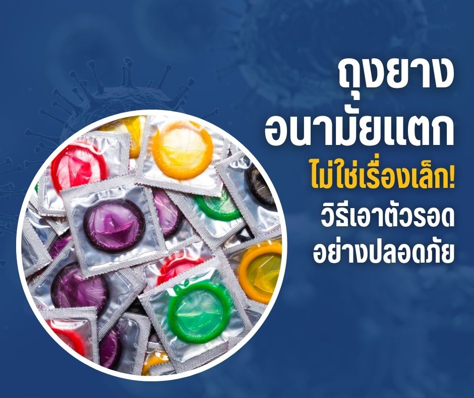 ถุงยางอนามัยแตกไม่ใช่เรื่องเล็ก! วิธีเอาตัวรอดอย่างปลอดภัย