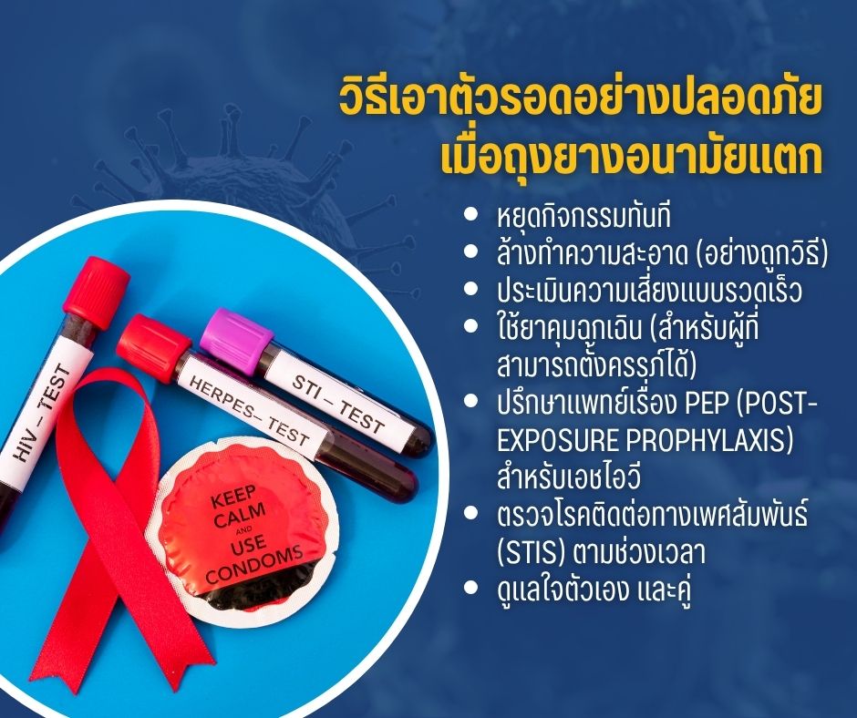 วิธีเอาตัวรอดอย่างปลอดภัยเมื่อถุงยางอนามัยแตก