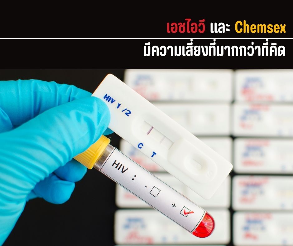 เอชไอวี และ Chemsex มีความเสี่ยงที่มากกว่าที่คิด