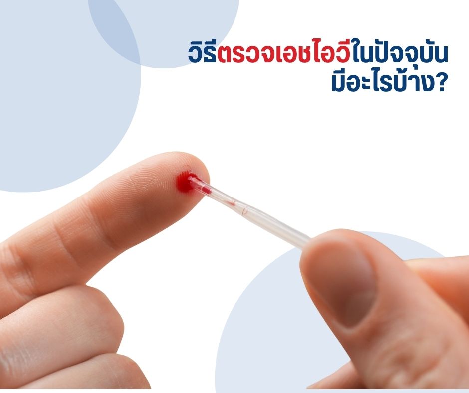 วิธีตรวจเอชไอวีในปัจจุบัน มีอะไรบ้าง